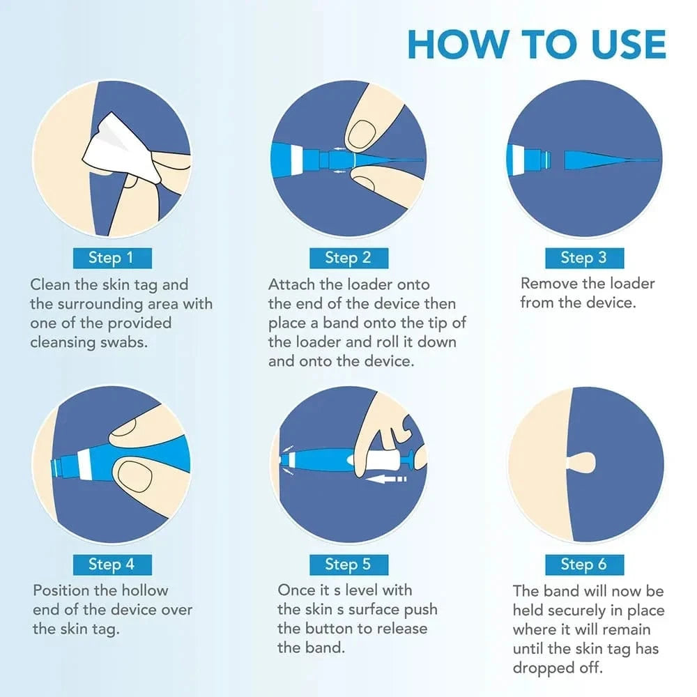 Manual Wart Removal Device At Home